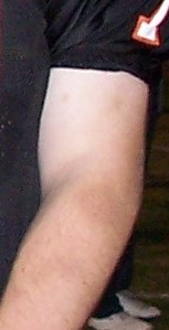 Name:  Bruise.jpg
Views: 398
Size:  15.6 KB