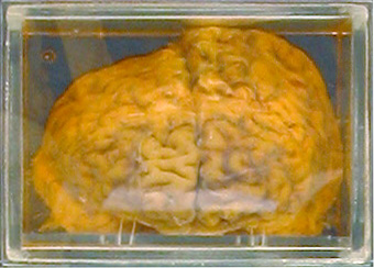 Name:  Place's Brain.jpg
Views: 4275
Size:  64.3 KB
