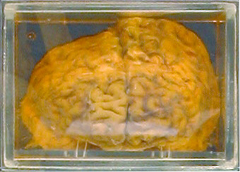 Name:  Place's Brain.jpg
Views: 4592
Size:  64.3 KB