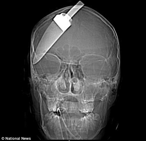 Name:  X-ray 1.jpg
Views: 5522
Size:  32.5 KB