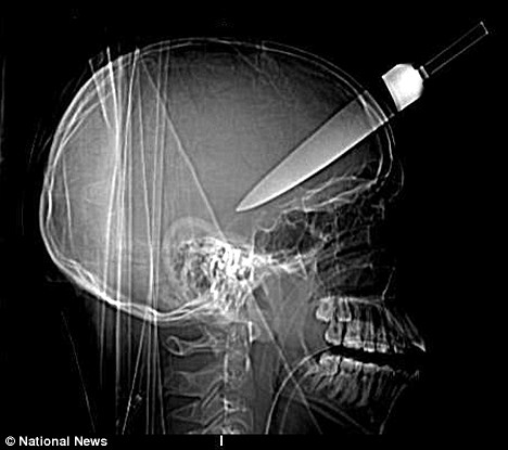 Name:  X-ray 2.jpg
Views: 5360
Size:  39.9 KB
