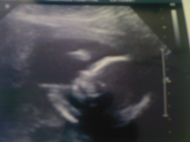 Name:  baby boy 19 weeks.jpg
Views: 132
Size:  55.1 KB