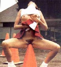 Name:  silly cone implant.jpg
Views: 1994
Size:  39.9 KB