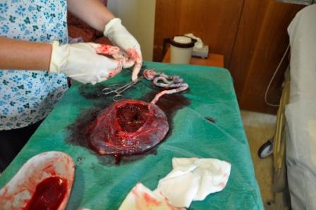 Name:  Placenta.jpg
Views: 232
Size:  66.5 KB