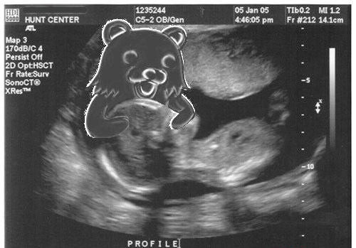 Name:  pedobear-in-the-womb.jpg
Views: 1059
Size:  43.3 KB