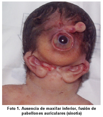 Name:  cyclops_baby_medico.jpg
Views: 4507
Size:  65.6 KB