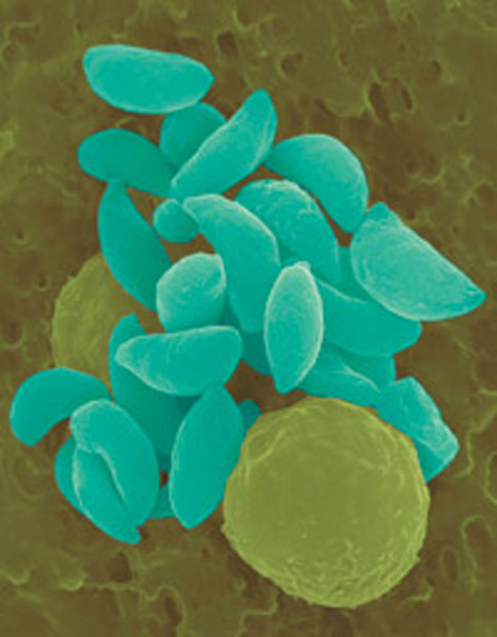 Name:  tgondii.jpg
Views: 2356
Size:  92.3 KB