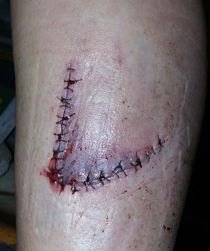 Name:  ouchie.jpg
Views: 333
Size:  45.6 KB