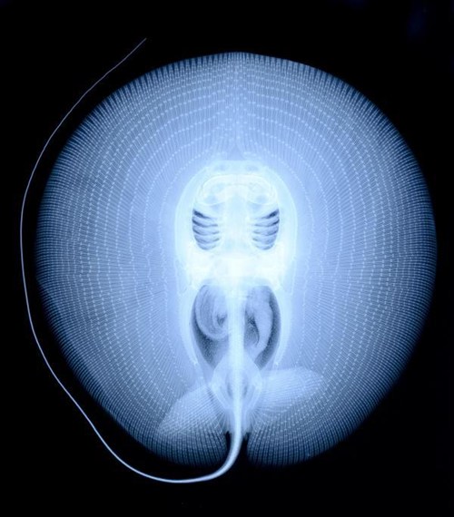 Name:  RayXray.jpg
Views: 4892
Size:  53.3 KB