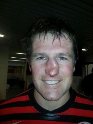 Name:  Ernst-Jouberts-rugby-nose.jpg
Views: 2907
Size:  22.0 KB