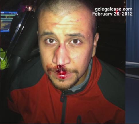 Name:  Zimmerman_2.jpg
Views: 226
Size:  20.1 KB