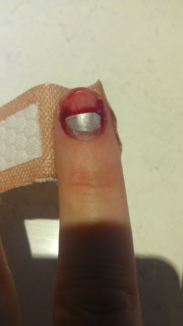 Name:  no fingernail (361x640).jpg
Views: 318
Size:  103.2 KB