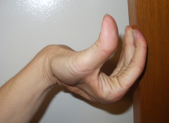 Name:  finger-hyperextension1.jpg
Views: 5288
Size:  151.5 KB