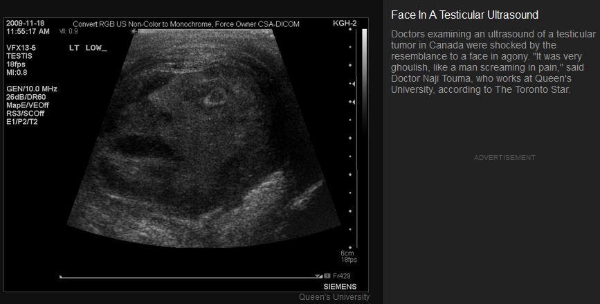 Name:  ballface.JPG
Views: 632
Size:  49.0 KB