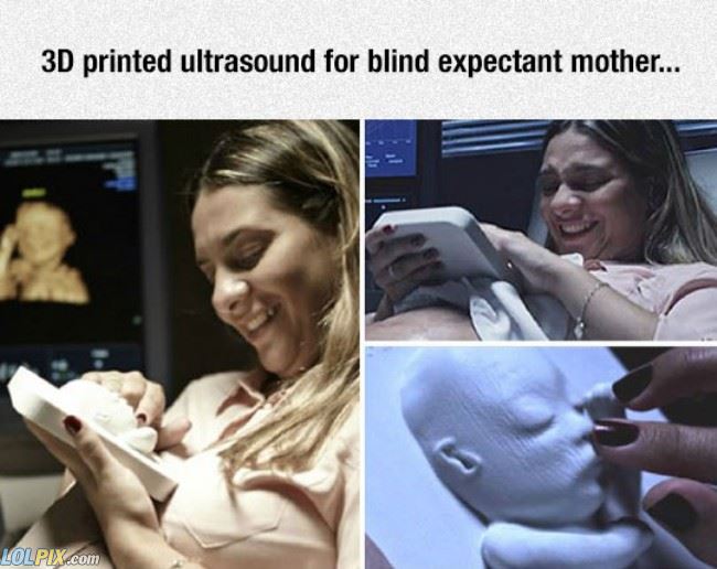 Name:  3d_Ultrasound.jpg
Views: 1842
Size:  55.0 KB