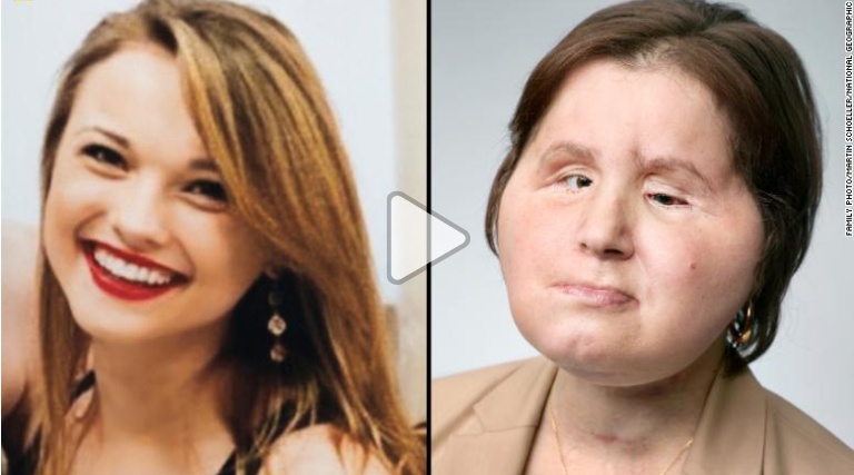 Name:  before and after.jpg
Views: 898
Size:  81.2 KB