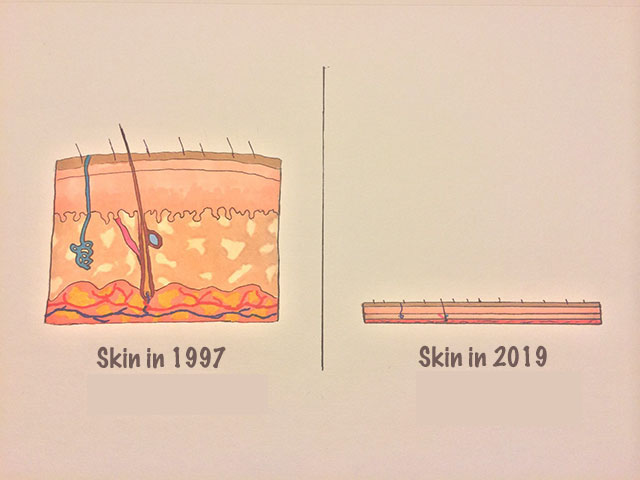 Name:  thinskin.jpg
Views: 1983
Size:  36.5 KB
