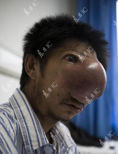 Name:  big-nosed-guy-5.jpg
Views: 556
Size:  23.2 KB